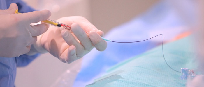 Camera implantabila